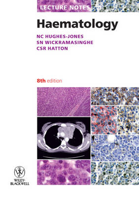 Lecture Notes: Haematology - Lecture Notes (Paperback)