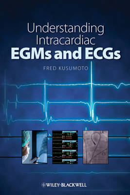 Understanding Intracardiac EGMs and ECGs (Paperback)
