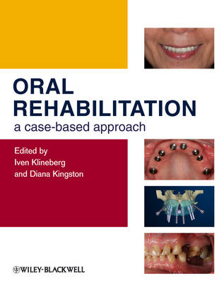Oral Rehabilitation - a Case-based Approach (Hardback)