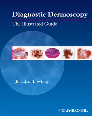 Diagnostic Dermoscopy: The Illustrated Guide (Paperback)