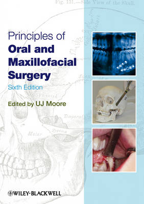 Principles of Oral and Maxillofacial Surgery (Paperback)