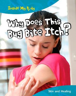 Why does this Bite Itch? - Inside My Body (Paperback)