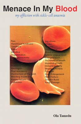 Menace in My Blood: My Affliction with Sickle-cell Anemia (Paperback)