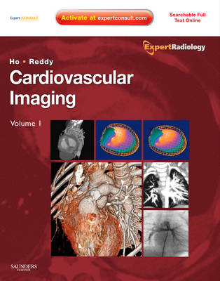 Cardiovascular Imaging, 2-Volume Set: Expert Radiology Series - Expert Radiology (Hardback)