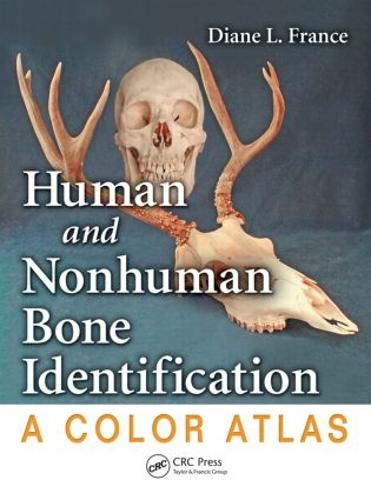 Human and Nonhuman Bone Identification: A Color Atlas (Hardback)