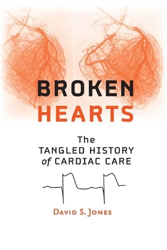 Broken Hearts: The Tangled History of Cardiac Care (Paperback)