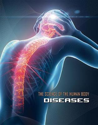 Science of the Human Body: Diseases - Science of the Human Body (Hardback)