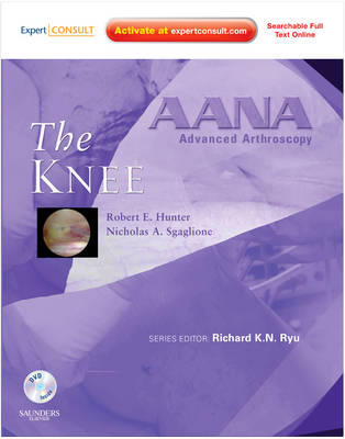 AANA Advanced Arthroscopy: The Knee: Expert Consult: Online, Print and DVD - AANA Advanced Arthroscopy (Hardback)