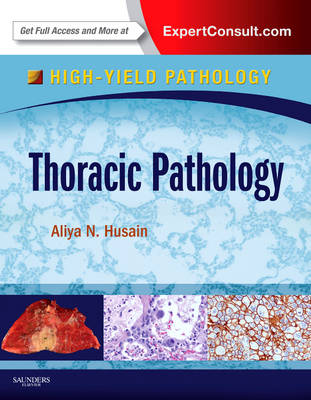Thoracic Pathology: A Volume in the High Yield Pathology Series (Expert Consult - Online and Print) - High Yield Pathology (Hardback)
