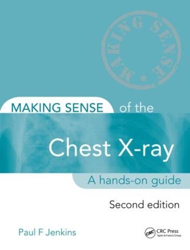 Making Sense of the Chest X-ray, Second Edition: A hands-on guide - Making Sense of (Paperback)