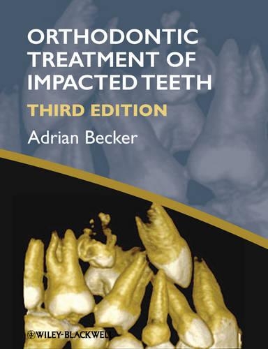 Orthodontic Treatment of Impacted Teeth (Hardback)