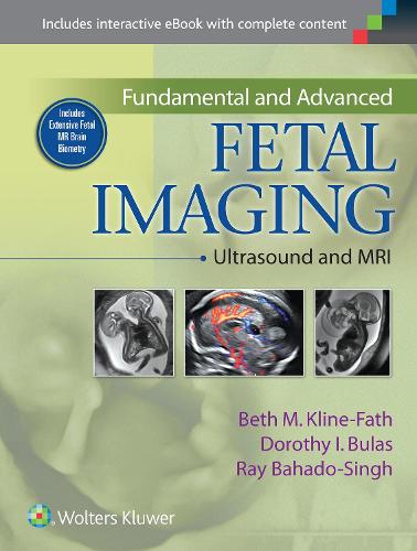 Fundamental and Advanced Fetal Imaging: Ultrasound and MRI (Hardback)