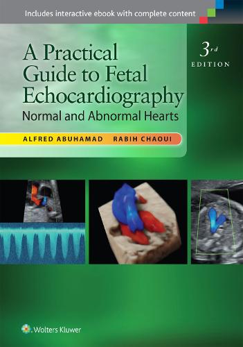 A Practical Guide to Fetal Echocardiography: Normal and Abnormal Hearts (Hardback)
