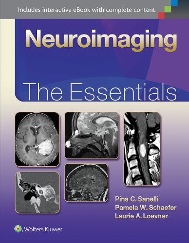 Neuroimaging: The Essentials - Essentials Series (Hardback)