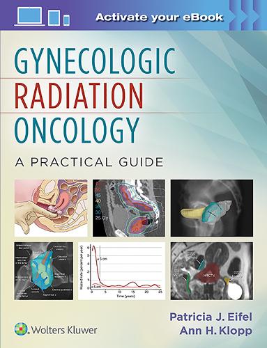 Gynecologic Radiation Oncology: A Practical Guide (Hardback)