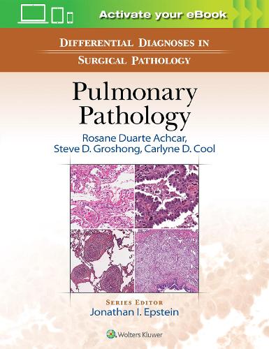 Differential Diagnosis in Surgical Pathology: Pulmonary Pathology (Hardback)