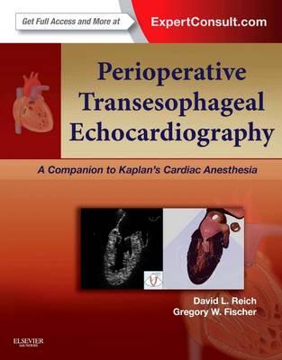 Perioperative Transesophageal Echocardiography By David