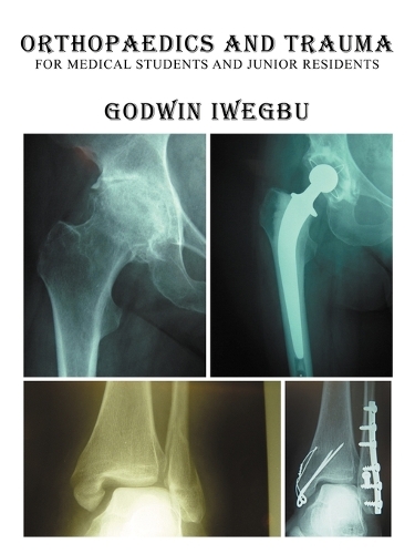 Orthopaedics and Trauma for Medical Students and Junior Residents (Paperback)