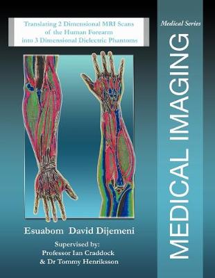 Medical Imaging: Translating 2 Dimensional MRI Scans of the Human Forearm into 3 Dimensional Dielectric Phantoms (Paperback)