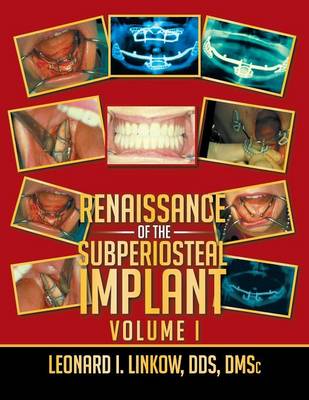 Renaissance of the Subperiosteal Implant Volume I (Paperback)