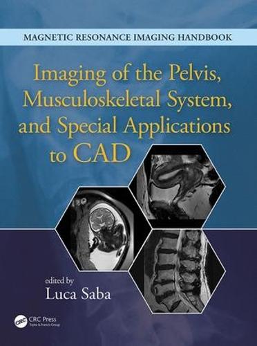 Imaging of the Pelvis, Musculoskeletal System, and Special Applications to CAD (Hardback)