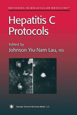 Hepatitis C Protocols - Methods in Molecular Medicine 19 (Paperback)