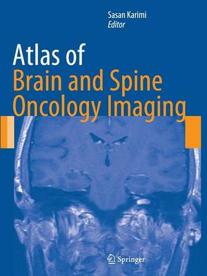 Atlas of Brain and Spine Oncology Imaging - Atlas of Oncology Imaging (Paperback)
