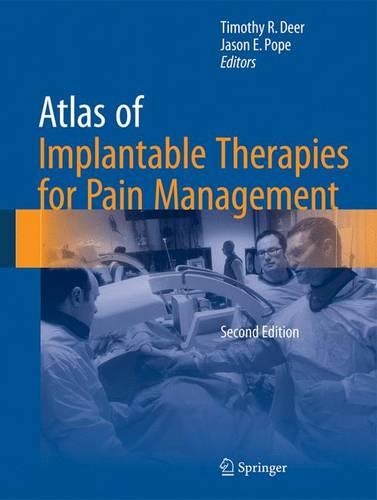 Atlas of Implantable Therapies for Pain Management (Hardback)