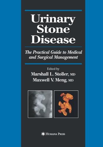 Urinary Stone Disease: The Practical Guide to Medical and Surgical Management - Current Clinical Urology (Paperback)