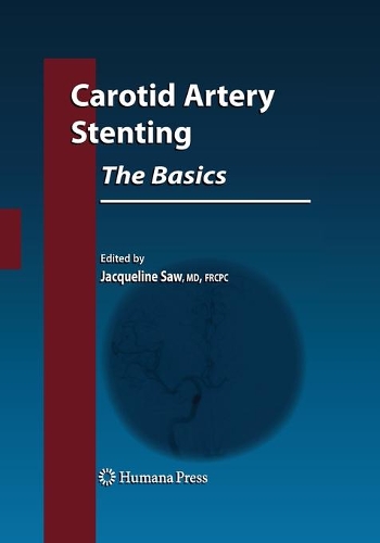 Carotid Artery Stenting: The Basics - Contemporary Cardiology (Paperback)