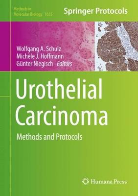 Cover Urothelial Carcinoma: Methods and Protocols - Methods in Molecular Biology 1655