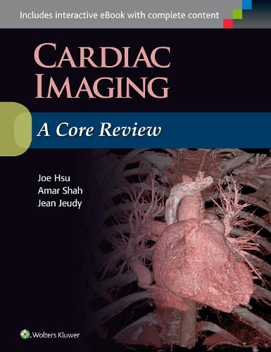 Cardiac Imaging: A Core Review (Paperback)