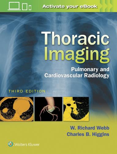 Thoracic Imaging: Pulmonary and Cardiovascular Radiology (Hardback)
