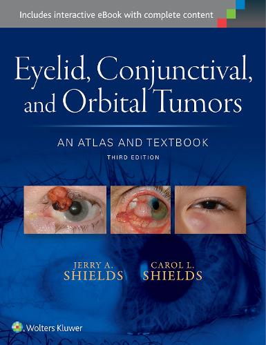 Eyelid, Conjunctival, and Orbital Tumors: An Atlas and Textbook (Hardback)