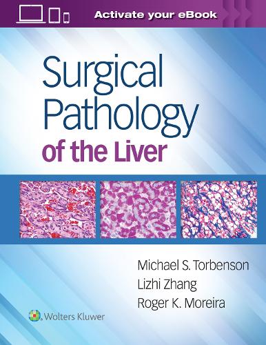 Surgical Pathology of the Liver (Hardback)