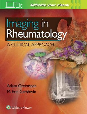Imaging in Rheumatology: A Clinical Approach (Hardback)