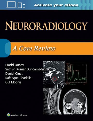 Neuroradiology: A Core Review (Paperback)