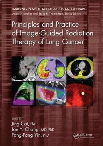 Cover Principles and Practice of Image-Guided Radiation Therapy of Lung Cancer - Imaging in Medical Diagnosis and Therapy