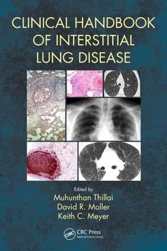 Clinical Handbook of Interstitial Lung Disease (Paperback)