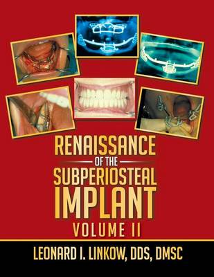 Renaissance of the Subperiosteal Implant: Volume II (Paperback)