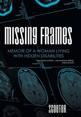 Missing Frames: Memoir of a Woman Living with Hidden Disabilities (Hardback)
