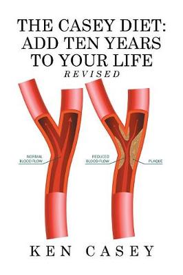 The Casey Diet: Add Ten Years to Your Life (Paperback)