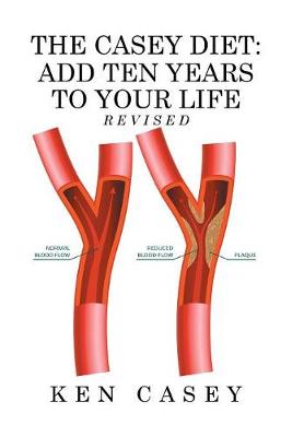 The Casey Diet: Add Ten Years to Your Life (Hardback)