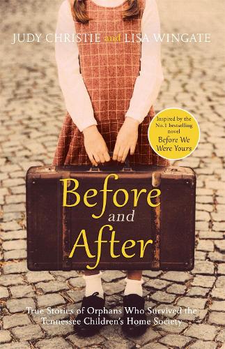 Before and After alternative edition book cover