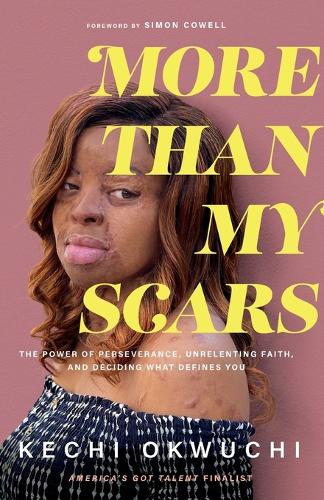 More Than My Scars – The Power of Perseverance, Unrelenting Faith, and Deciding What Defines You (Paperback)