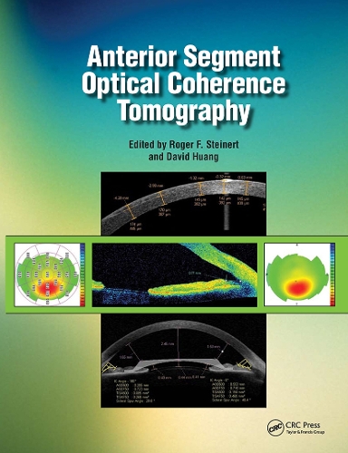 Anterior Segment Optical Coherence Tomography (Hardback)