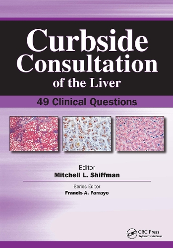 Curbside Consultation of the Liver: 49 Clinical Questions (Paperback)