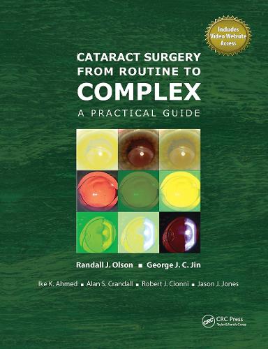Cataract Surgery from Routine to Complex: A Practical Guide (Hardback)