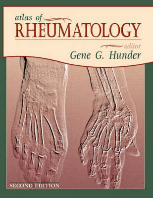 Atlas of Rheumatology (Hardback)