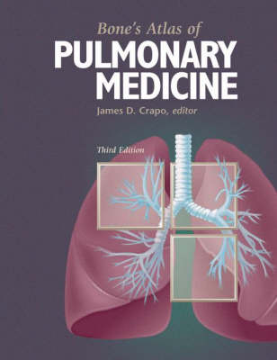 Bone's Atlas of Pulmonary Medicine (Hardback)